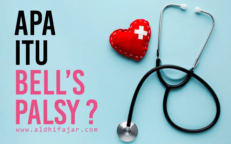 Kupas Tuntas Penyakit Bell'S Palsy 1 Penyakit bell's Palsy
