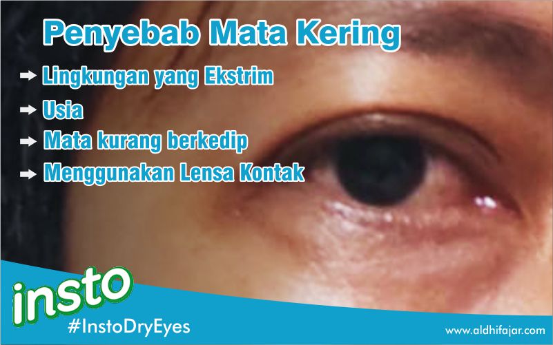 Insto Dry Eyes, Mata Kering Saat Touring Jangan SePeLein 2 Penyebab Mata Kering