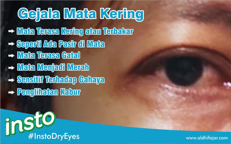Insto Dry Eyes, Mata Kering Saat Touring Jangan SePeLein 3 Gejala Mata Kering