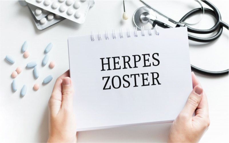 Kenali Gejala dan Penyebab Herpes Zoster Serta Pengobatannya 1 Penyakit herpes zoster gejala dan penyembuhannya