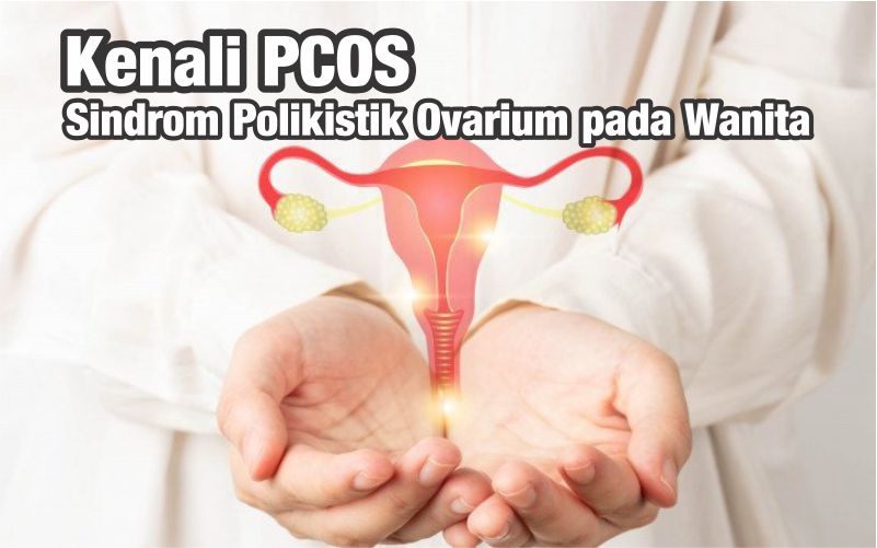 Kenali PCOS atau Sindrom Polikistik Ovarium pada Wanita 1 Apa itu PCOS? kenali gejala dan dampak PCOS