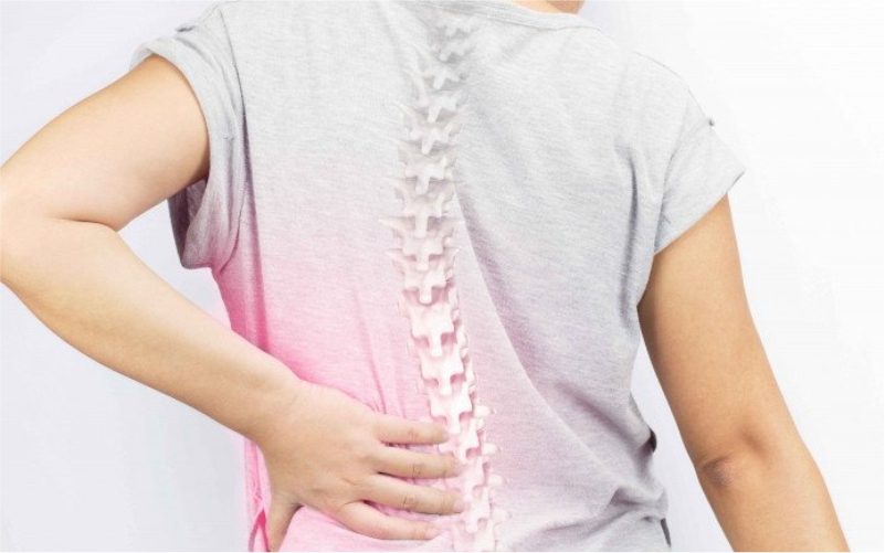 Skoliosis Adalah Kelainan Tulang Belakang